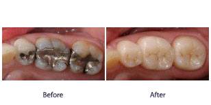 Before and After Before and After